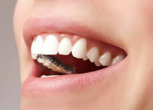 電動牙刷刷牙好嗎 電動牙刷刷牙好嗎