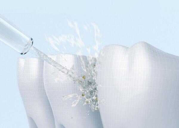 用電動牙刷還是沖牙器 牙菌斑是用電動牙刷還是沖牙器