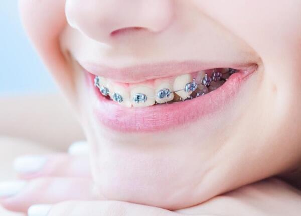 戴了牙套使用電動牙刷方法 戴了牙套怎么使用電動牙刷